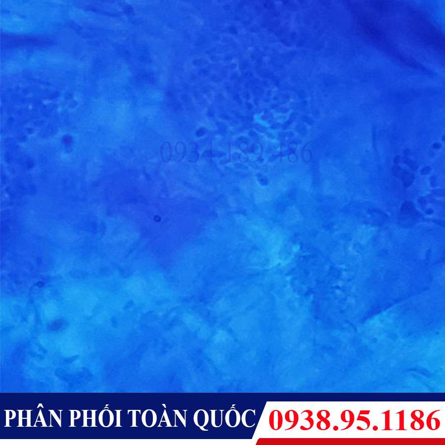 tieu ban benh pham Lang ben-2