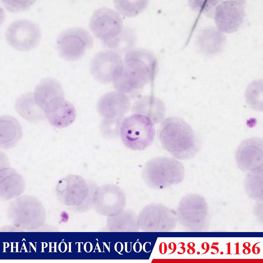 tieu ban ky sinh trung sot ret Plasmodium Falciparum - 1