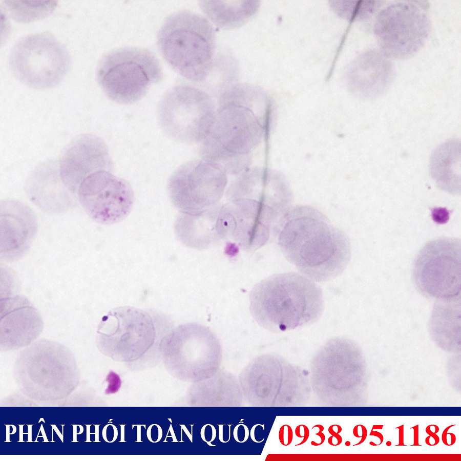 tieu ban ky sinh trung sot ret Plasmodium Falciparum - 4